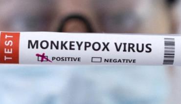 В Беларуси сформированы прочные барьеры против вспышки оспы обезьян 